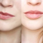 7 fashionable lip shapes that can be achieved with augmentation from a cosmetologist