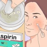 aspirin for acne