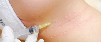 биоревитализация шеи - как выглядит кожа после введения инъекций