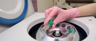 Doctor inserts a test tube into a centrifuge