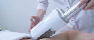 Endosphere therapy for cellulite