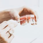 stages of dental implant installation
