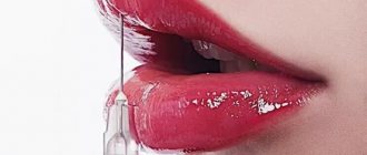 Lip guide: shape and photos of lip augmentation using different techniques. Choose! 