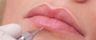 Fordyce granules and permanent lip makeup. Photos before and after, reviews 