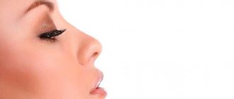 Искривление перегородки носа