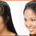 How to remove hair on forehead