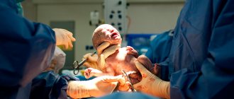 How to take care of yourself after a caesarean section