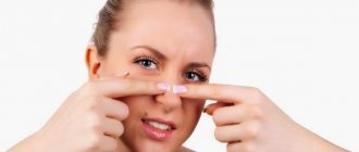 How to squeeze out blackheads on the nose at home