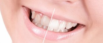 какое отбеливание зубов самое безопасное и эффективное
