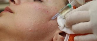 When is the best time to take vitamin injections for the face?