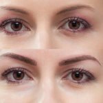 Correction of permanent eyebrow makeup. How does healing and care occur? 