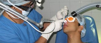 лазерная операция по исправлению носовой перегородки