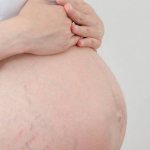 Treatment of atopic dermatitis during pregnancy