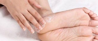 The best remedies for warts
