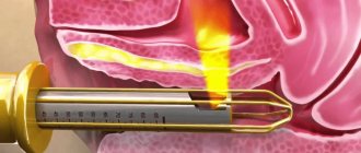 The mechanism of laser vaginal rejuvenation