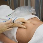 Озонотерапия для беременных