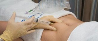 Ozone therapy for pregnant women