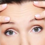 Forehead and eyebrow lift – Techniques