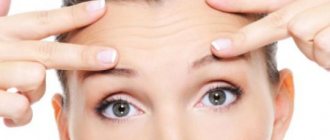 Forehead and eyebrow lift – Techniques