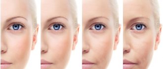 Gradual formation of fine wrinkles on the face
