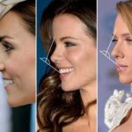 Examples of an ideal nose in women
