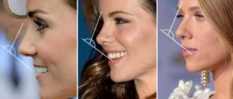 Examples of an ideal nose in women