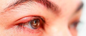 signs of the upper eyelid