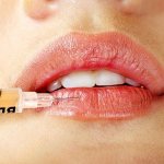 Biorevitalization of lips is carried out