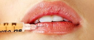 Biorevitalization of lips is carried out