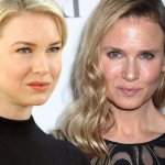 renee zellweger before and after plastic surgery