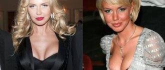 Russian actresses with large breasts before and after plastic surgery. Photo 