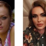 Slava Kaminskaya before and after plastic surgery