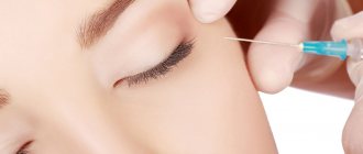 The consequence of popular beauty injections is sometimes ptosis (drooping) of the upper eyelid.