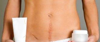 cost of scar removal