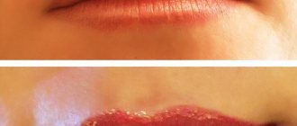 The importance of lip care after tattooing
