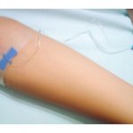 Intravenous ozone therapy