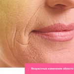 Возрастные изменения в области губ
