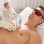 Time for a procedure such as laser hair removal